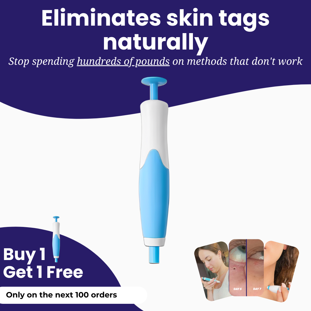 TagPal Removal Kit | Say goodbye to skin tags